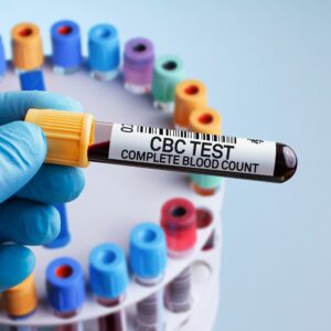 Complete Blood Count