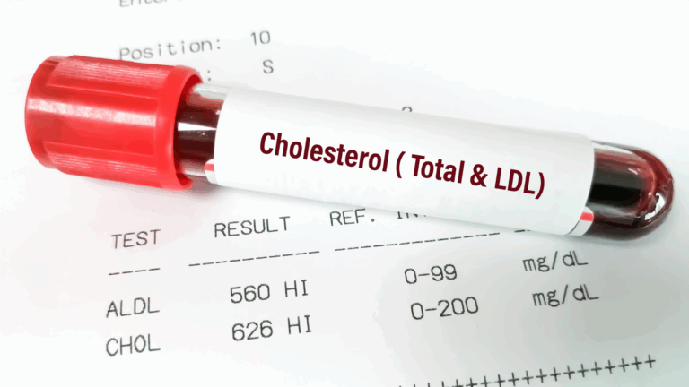 Cholesterol Test Overview